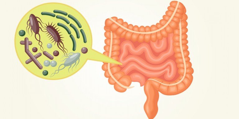 Дисбактериоз кишечника