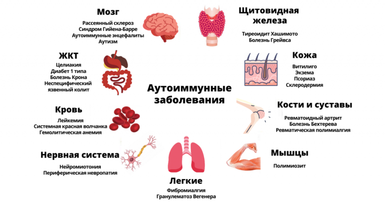 Диета при аутоиммунных заболеваниях